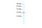 Small Nuclear RNA Activating Complex Polypeptide 2 antibody, 31-240, ProSci, Western Blot image 