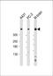 Dynein Cytoplasmic 1 Heavy Chain 1 antibody, M03059, Boster Biological Technology, Western Blot image 