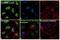 ATM Serine/Threonine Kinase antibody, MA5-15185, Invitrogen Antibodies, Immunofluorescence image 