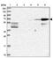 CAP-Gly Domain Containing Linker Protein Family Member 4 antibody, PA5-60341, Invitrogen Antibodies, Western Blot image 