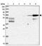 CAP-Gly Domain Containing Linker Protein Family Member 4 antibody, PA5-60341, Invitrogen Antibodies, Western Blot image 