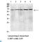 C-Type Lectin Domain Family 4 Member M antibody, LS-C813804, Lifespan Biosciences, Western Blot image 