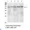 C-type lectin domain family 4 member M antibody, LS-C813804, Lifespan Biosciences, Western Blot image 