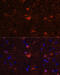 S100 Calcium Binding Protein B antibody, 13-241, ProSci, Immunofluorescence image 