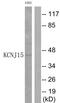 Potassium Voltage-Gated Channel Subfamily J Member 15 antibody, TA314133, Origene, Western Blot image 