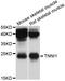 Troponin I1, Slow Skeletal Type antibody, STJ25907, St John