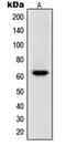 RNA Polymerase III Subunit C antibody, orb215005, Biorbyt, Western Blot image 