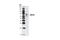 ATP Binding Cassette Subfamily G Member 2 (Junior Blood Group) antibody, 4477S, Cell Signaling Technology, Western Blot image 