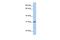 SRP Receptor Subunit Beta antibody, PA5-43390, Invitrogen Antibodies, Western Blot image 