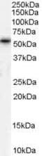 Transmembrane Phosphatase With Tensin Homology antibody, PA5-18563, Invitrogen Antibodies, Western Blot image 