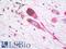 Melanocortin 1 Receptor antibody, LS-A1040, Lifespan Biosciences, Immunohistochemistry paraffin image 