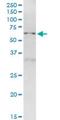 Nucleoporin 50 antibody, H00010762-M01, Novus Biologicals, Western Blot image 