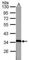 Annexin A5 antibody, PA5-27872, Invitrogen Antibodies, Western Blot image 