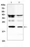 Interleukin 11 antibody, A01160-1, Boster Biological Technology, Western Blot image 