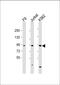 Nucleoporin 93 antibody, 61-286, ProSci, Western Blot image 