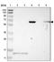 Junctophilin 1 antibody, NBP1-83075, Novus Biologicals, Western Blot image 