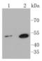 Sonic hedgehog protein antibody, A00058, Boster Biological Technology, Western Blot image 