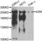 Alpha-2-Macroglobulin antibody, abx001324, Abbexa, Western Blot image 