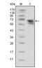 Neurotrophic Receptor Tyrosine Kinase 1 antibody, MA5-15509, Invitrogen Antibodies, Western Blot image 