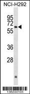 Aristaless Related Homeobox antibody, 58-675, ProSci, Western Blot image 