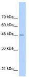 Toll Like Receptor 6 antibody, TA329400, Origene, Western Blot image 