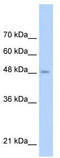 Toll-like receptor 6 antibody, TA329400, Origene, Western Blot image 