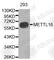 Methyltransferase Like 16 antibody, A5998, ABclonal Technology, Western Blot image 