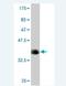 Calcium Voltage-Gated Channel Subunit Alpha1 F antibody, H00000778-M05, Novus Biologicals, Western Blot image 