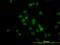 Histone Deacetylase 1 antibody, LS-B6097, Lifespan Biosciences, Immunofluorescence image 