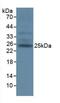 T Cell Immunoreceptor With Ig And ITIM Domains antibody, MBS2003430, MyBioSource, Western Blot image 