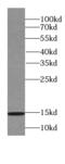 Putative beta-glucuronidase-like protein SMA3 antibody, FNab07991, FineTest, Western Blot image 