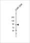 Hdm2 antibody, 56-498, ProSci, Western Blot image 
