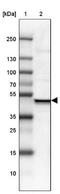 Ubiquitin Specific Peptidase 16 antibody, NBP1-86881, Novus Biologicals, Western Blot image 