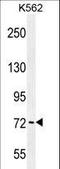 P21 (RAC1) Activated Kinase 6 antibody, LS-B9301, Lifespan Biosciences, Western Blot image 