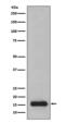 Prefoldin Subunit 5 antibody, M09908, Boster Biological Technology, Western Blot image 