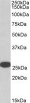 RAN Binding Protein 1 antibody, MBS420729, MyBioSource, Western Blot image 