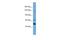 Tripartite Motif Containing 66 antibody, A14558, Boster Biological Technology, Western Blot image 