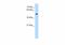Serine/Threonine/Tyrosine Kinase 1 antibody, GTX00635, GeneTex, Western Blot image 