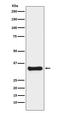 Thymidylate Synthetase antibody, M04320-1, Boster Biological Technology, Western Blot image 