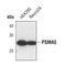 Proteasome Subunit Alpha 5 antibody, PA5-17295, Invitrogen Antibodies, Western Blot image 