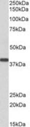 SET Nuclear Proto-Oncogene antibody, MBS420767, MyBioSource, Western Blot image 