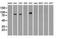 B-Raf Proto-Oncogene, Serine/Threonine Kinase antibody, NBP1-47668, Novus Biologicals, Western Blot image 