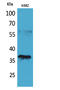 CD207 Molecule antibody, STJ96640, St John