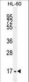 Complement C1q C Chain antibody, LS-C168048, Lifespan Biosciences, Western Blot image 