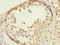COP9 signalosome complex subunit 3 antibody, LS-C675572, Lifespan Biosciences, Immunohistochemistry paraffin image 