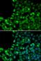 O-6-Methylguanine-DNA Methyltransferase antibody, LS-B13847, Lifespan Biosciences, Immunofluorescence image 