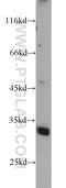 Family With Sequence Similarity 71 Member E2 antibody, 20904-1-AP, Proteintech Group, Western Blot image 
