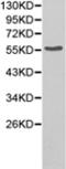 Parathyroid Hormone 1 Receptor antibody, TA321110, Origene, Western Blot image 