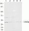 Proteasome Activator Subunit 3 antibody, 700180, Invitrogen Antibodies, Western Blot image 