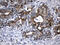 Carnitine Palmitoyltransferase 1B antibody, M03558, Boster Biological Technology, Immunohistochemistry paraffin image 